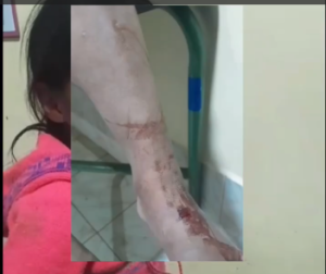 MENOR DE 7 AÑOS ES RESCATADA TRAS PRESUNTO CASO DE VIOLENCIA INTRAFAMILIAR EN ANDAHUAYLAS